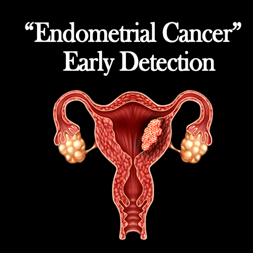 Endometrial Cancer - Early Detection – Shasthra Snehi